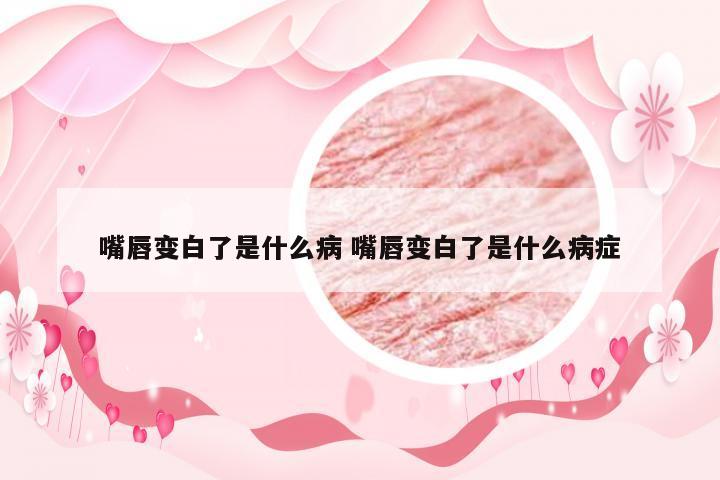 嘴唇变白了是什么病 嘴唇变白了是什么病症