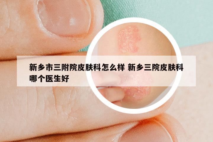 新乡市三附院皮肤科怎么样 新乡三院皮肤科哪个医生好