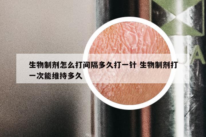 生物制剂怎么打间隔多久打一针 生物制剂打一次能维持多久