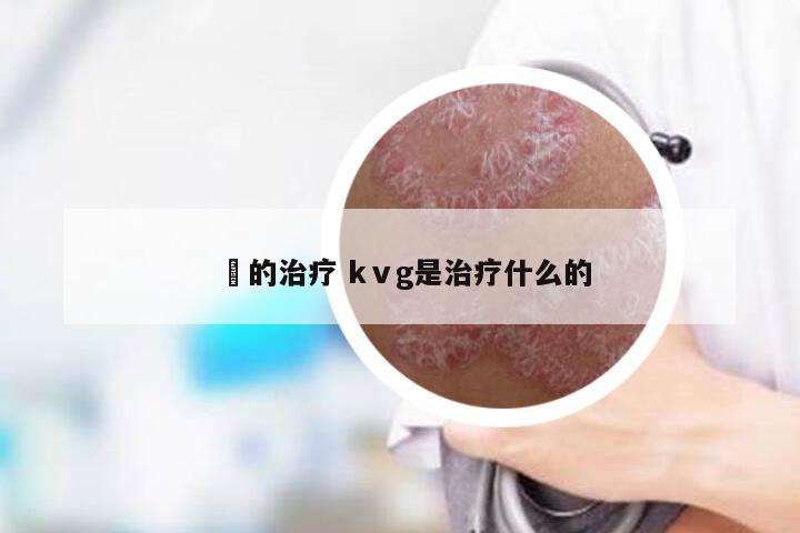 廯的治疗 kⅴg是治疗什么的