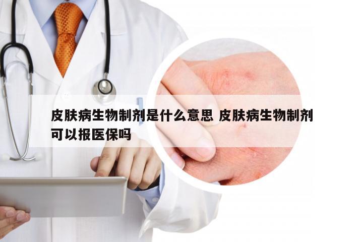 皮肤病生物制剂是什么意思 皮肤病生物制剂可以报医保吗