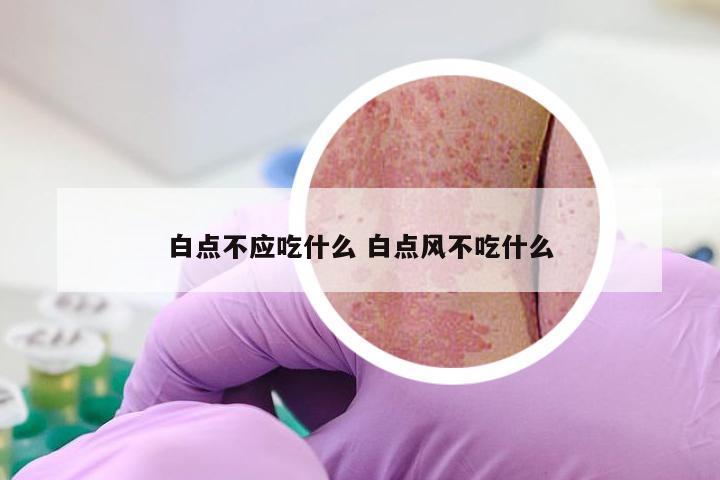 白点不应吃什么 白点风不吃什么