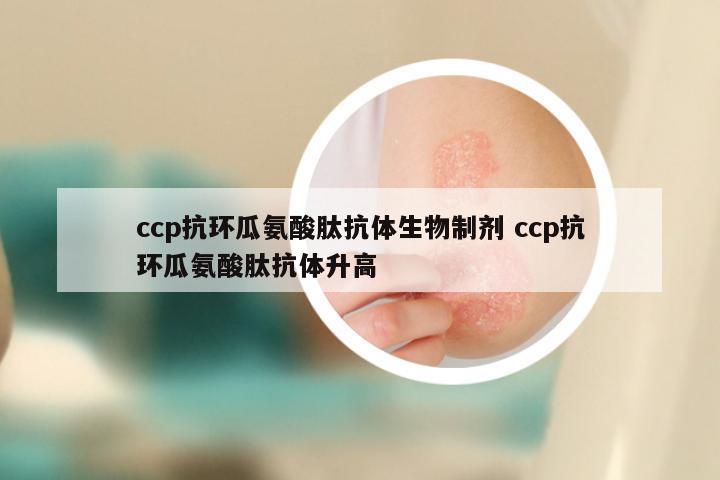 ccp抗环瓜氨酸肽抗体生物制剂 ccp抗环瓜氨酸肽抗体升高