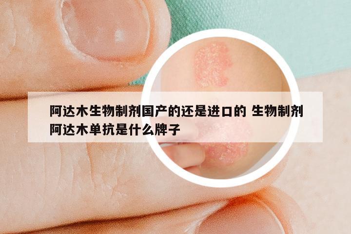 阿达木生物制剂国产的还是进口的 生物制剂阿达木单抗是什么牌子