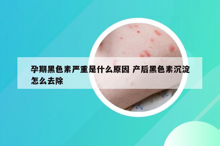 孕期黑色素严重是什么原因 产后黑色素沉淀怎么去除