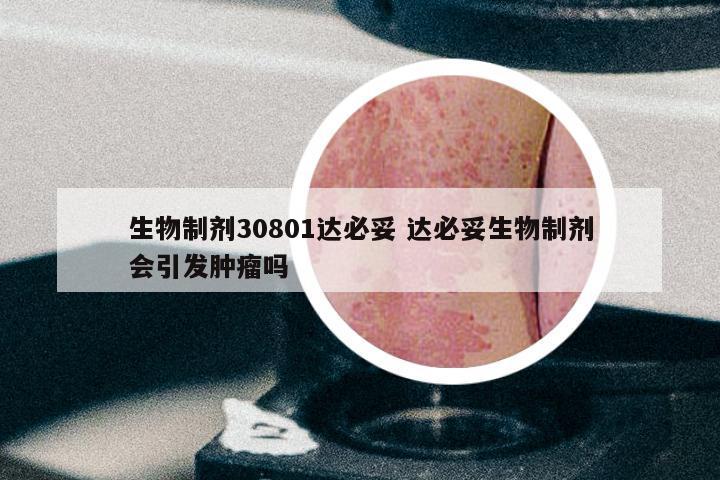 生物制剂30801达必妥 达必妥生物制剂会引发肿瘤吗