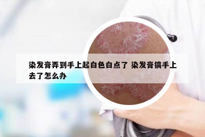 染发膏弄到手上起白色白点了 染发膏搞手上去了怎么办