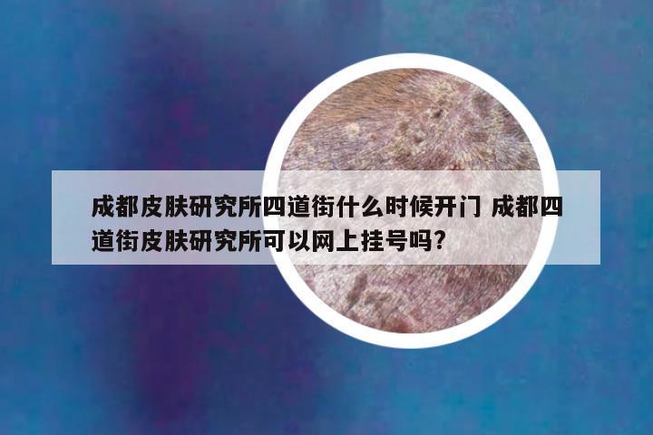 成都皮肤研究所四道街什么时候开门 成都四道街皮肤研究所可以网上挂号吗?