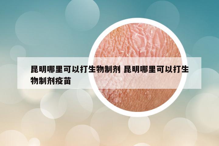 昆明哪里可以打生物制剂 昆明哪里可以打生物制剂疫苗