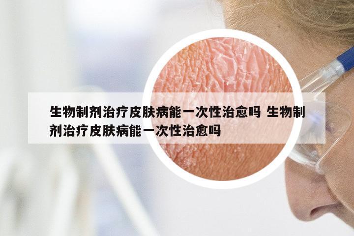 生物制剂治疗皮肤病能一次性治愈吗 生物制剂治疗皮肤病能一次性治愈吗