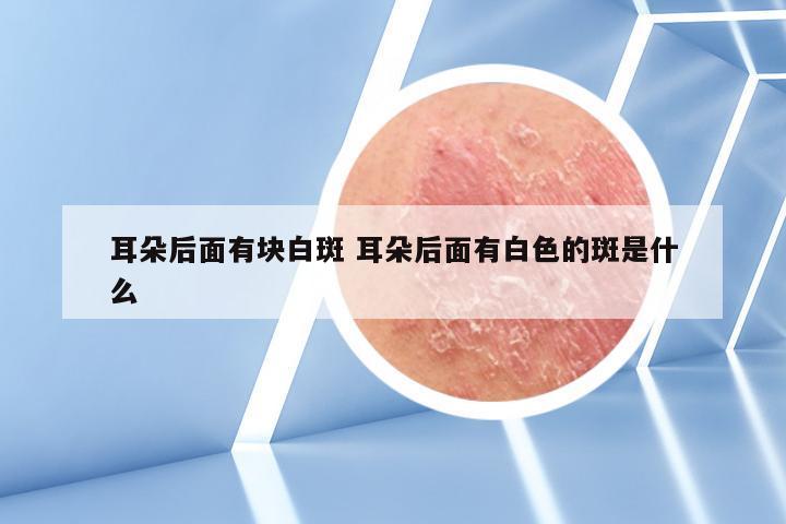 耳朵后面有块白斑 耳朵后面有白色的斑是什么