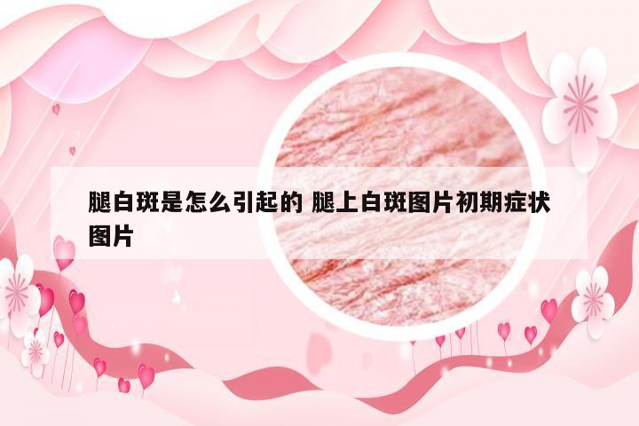 腿白斑是怎么引起的 腿上白斑图片初期症状图片