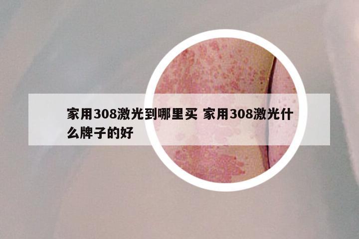 家用308激光到哪里买 家用308激光什么牌子的好