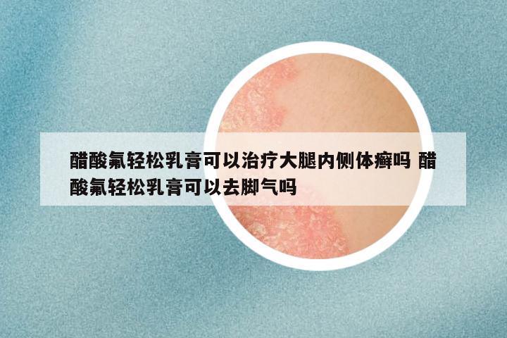 醋酸氟轻松乳膏可以治疗大腿内侧体癣吗 醋酸氟轻松乳膏可以去脚气吗