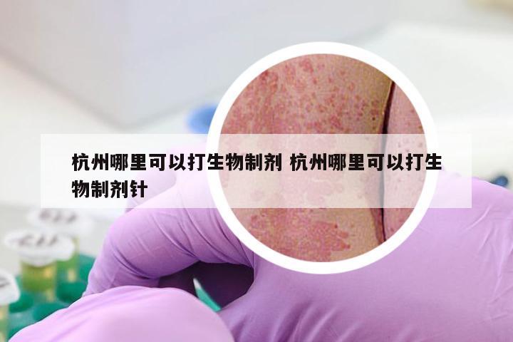 杭州哪里可以打生物制剂 杭州哪里可以打生物制剂针