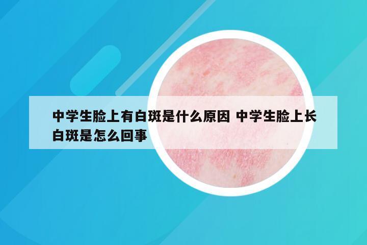 中学生脸上有白斑是什么原因 中学生脸上长白斑是怎么回事