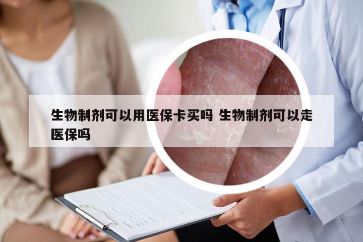 生物制剂可以用医保卡买吗 生物制剂可以走医保吗