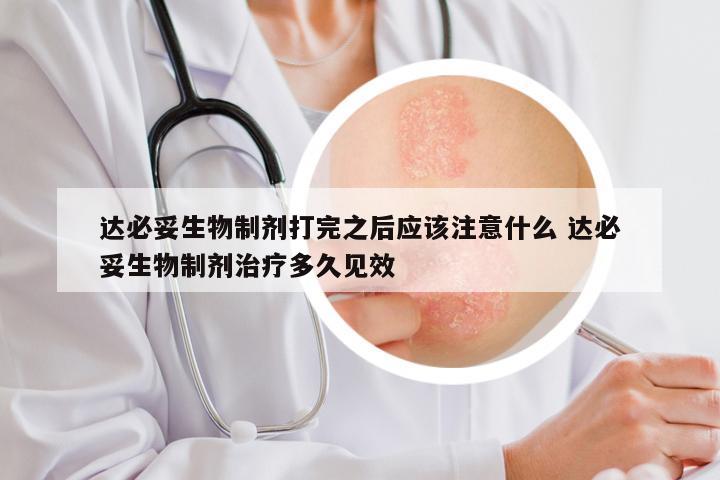 达必妥生物制剂打完之后应该注意什么 达必妥生物制剂治疗多久见效