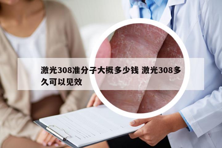 激光308准分子大概多少钱 激光308多久可以见效