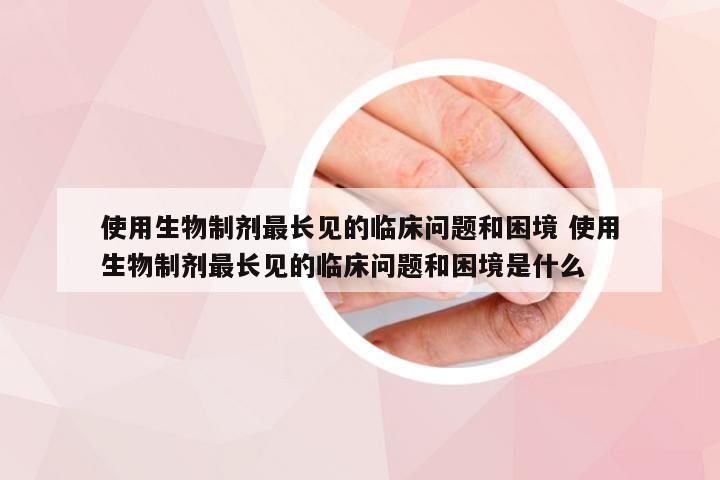 使用生物制剂最长见的临床问题和困境 使用生物制剂最长见的临床问题和困境是什么