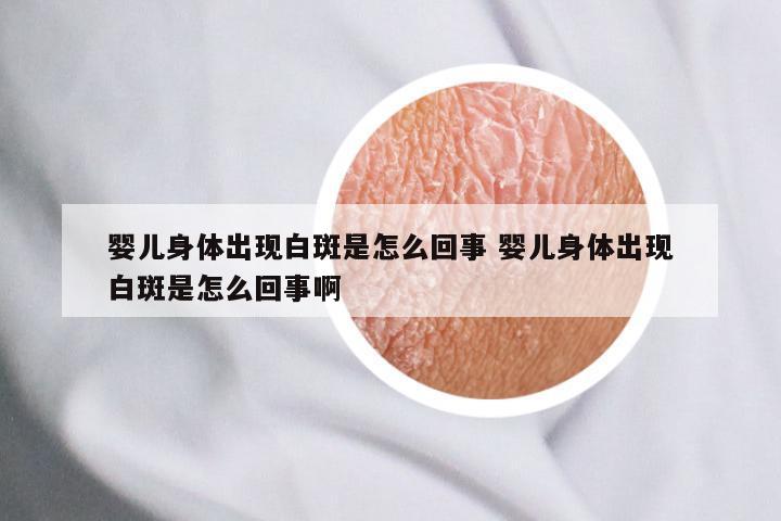 婴儿身体出现白斑是怎么回事 婴儿身体出现白斑是怎么回事啊