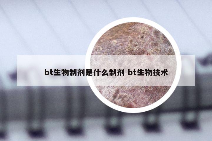 bt生物制剂是什么制剂 bt生物技术