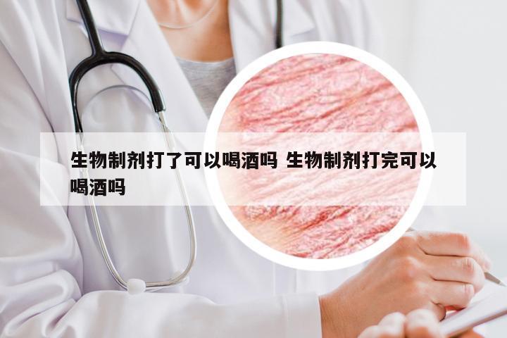 生物制剂打了可以喝酒吗 生物制剂打完可以喝酒吗