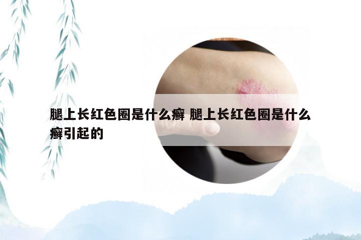 腿上长红色圈是什么癣 腿上长红色圈是什么癣引起的