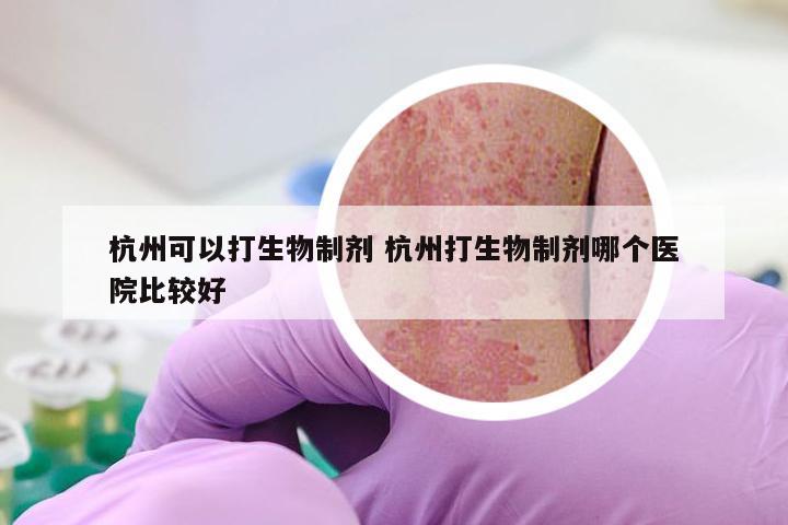 杭州可以打生物制剂 杭州打生物制剂哪个医院比较好