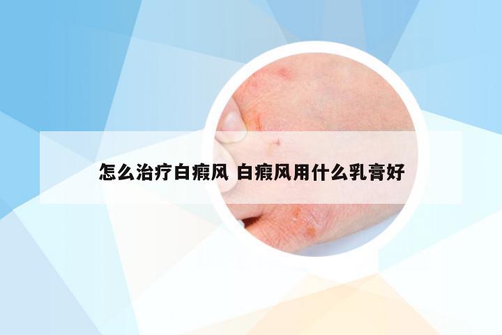 怎么治疗白瘕风 白瘕风用什么乳膏好