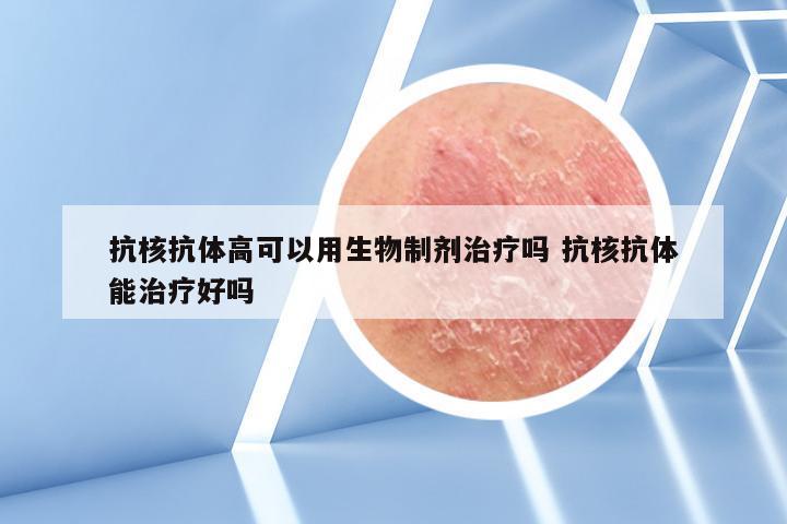 抗核抗体高可以用生物制剂治疗吗 抗核抗体能治疗好吗