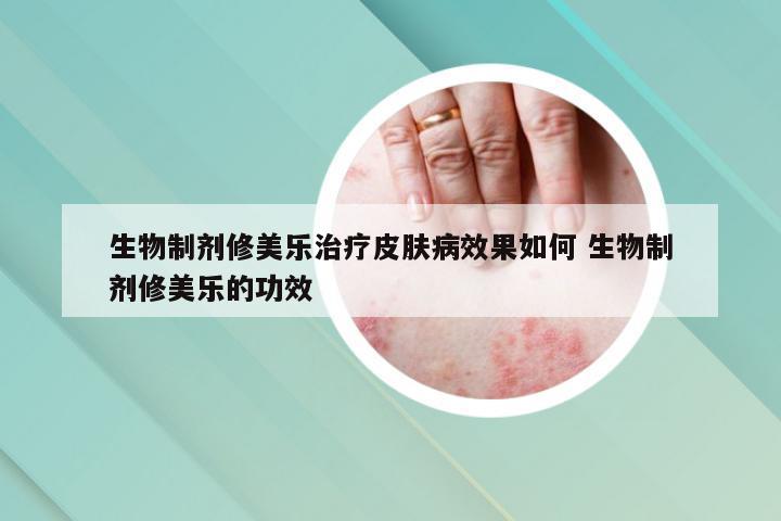 生物制剂修美乐治疗皮肤病效果如何 生物制剂修美乐的功效