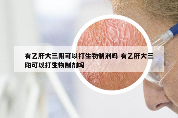 有乙肝大三阳可以打生物制剂吗 有乙肝大三阳可以打生物制剂吗