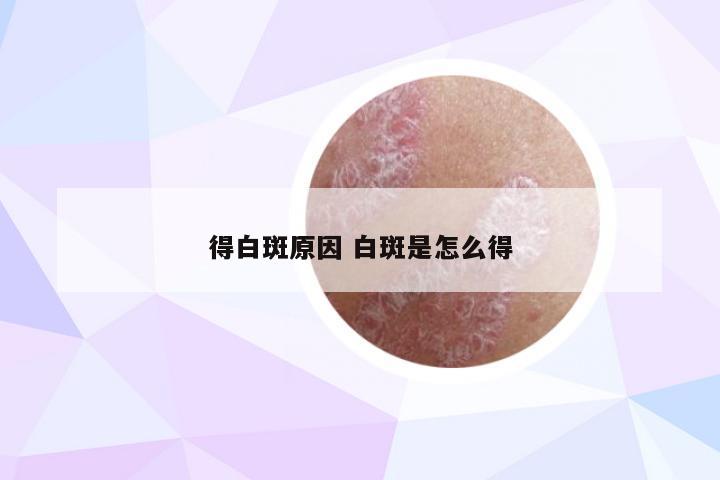 得白斑原因 白斑是怎么得