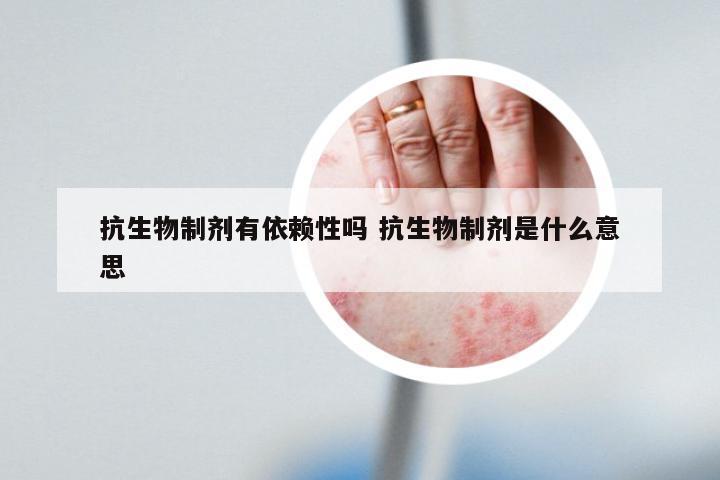 抗生物制剂有依赖性吗 抗生物制剂是什么意思