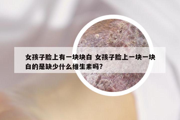 女孩子脸上有一块块白 女孩子脸上一块一块白的是缺少什么维生素吗?