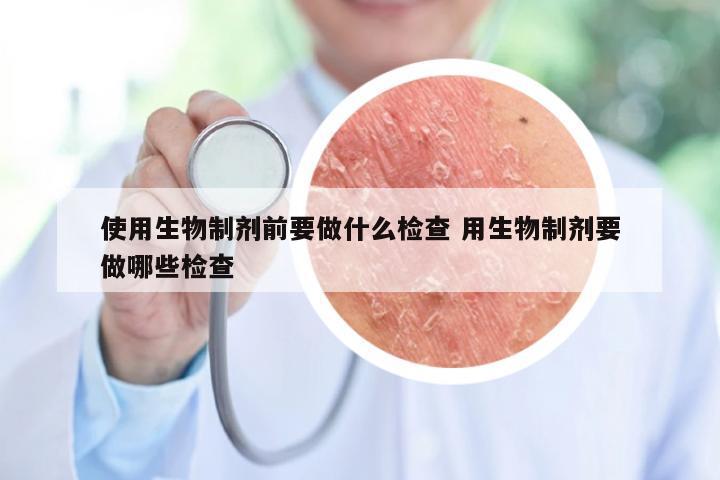 使用生物制剂前要做什么检查 用生物制剂要做哪些检查