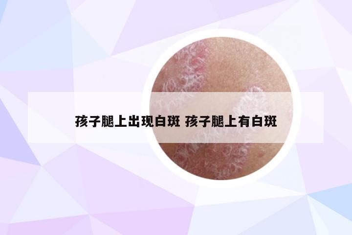 孩子腿上出现白斑 孩子腿上有白斑