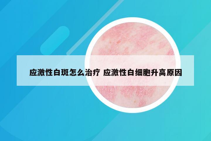 应激性白斑怎么治疗 应激性白细胞升高原因