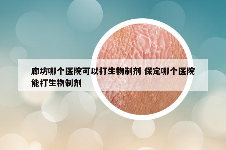 廊坊哪个医院可以打生物制剂 保定哪个医院能打生物制剂