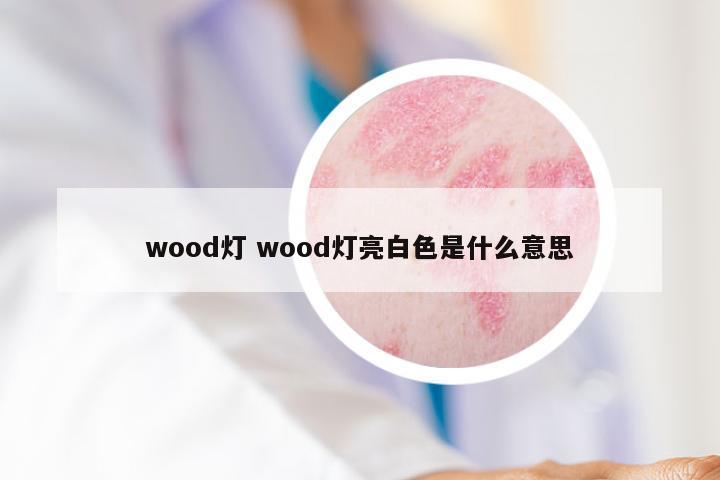 wood灯 wood灯亮白色是什么意思