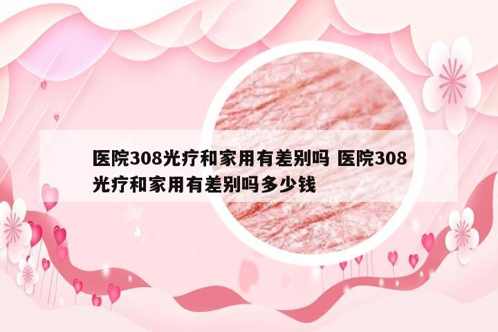 医院308光疗和家用有差别吗 医院308光疗和家用有差别吗多少钱