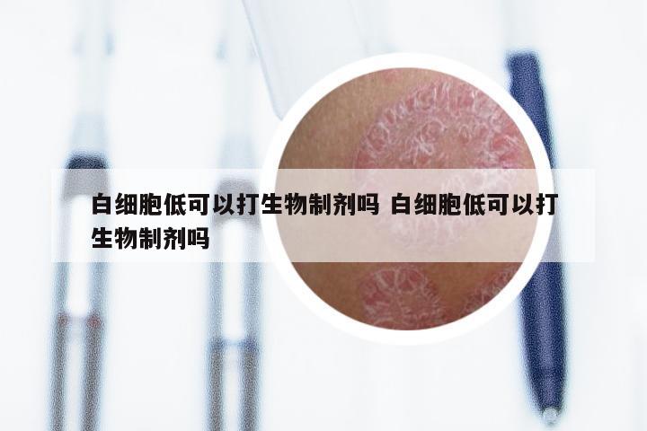 白细胞低可以打生物制剂吗 白细胞低可以打生物制剂吗