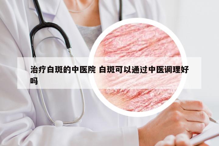 治疗白斑的中医院 白斑可以通过中医调理好吗