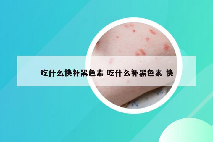 吃什么快补黑色素 吃什么补黑色素 快