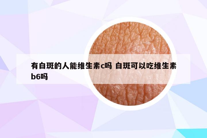 有白斑的人能维生素c吗 白斑可以吃维生素b6吗