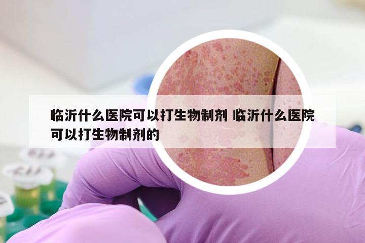 临沂什么医院可以打生物制剂 临沂什么医院可以打生物制剂的