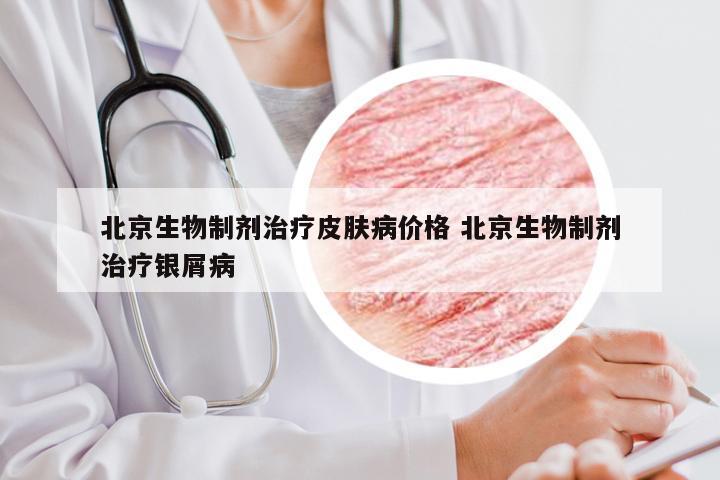 北京生物制剂治疗皮肤病价格 北京生物制剂治疗银屑病