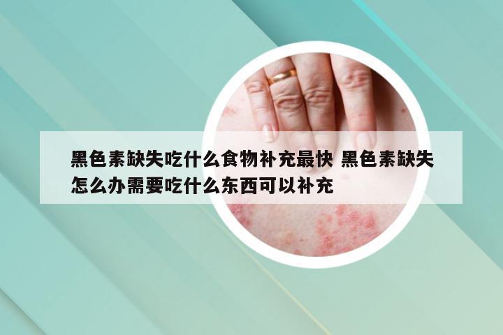 黑色素缺失吃什么食物补充最快 黑色素缺失怎么办需要吃什么东西可以补充