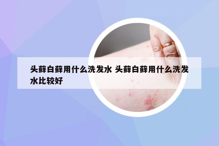 头藓白藓用什么洗发水 头藓白藓用什么洗发水比较好